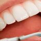 Dental Services in Hadston – Listening Event